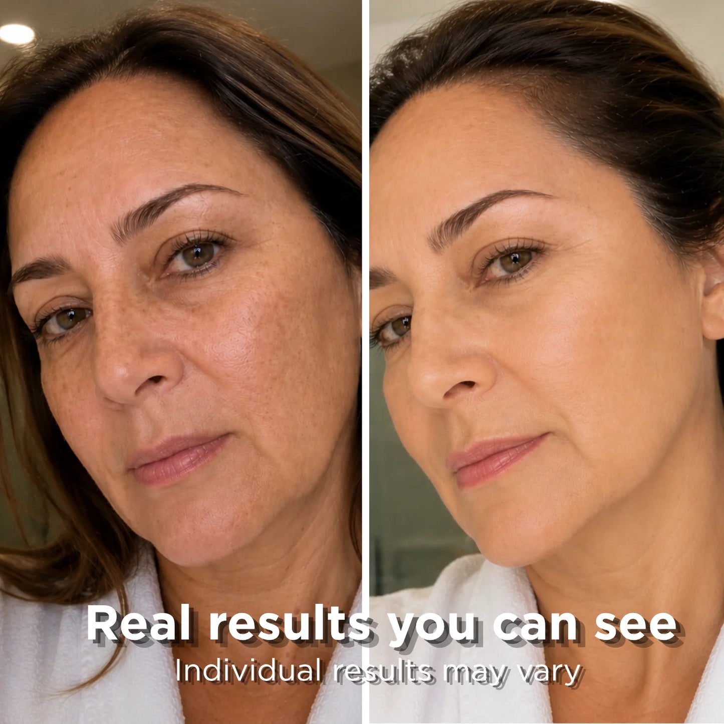 Anti-Aging Kit! - Firm & Lift Ice Facial Kit for Fine Lines, Firmness & Aging Skin