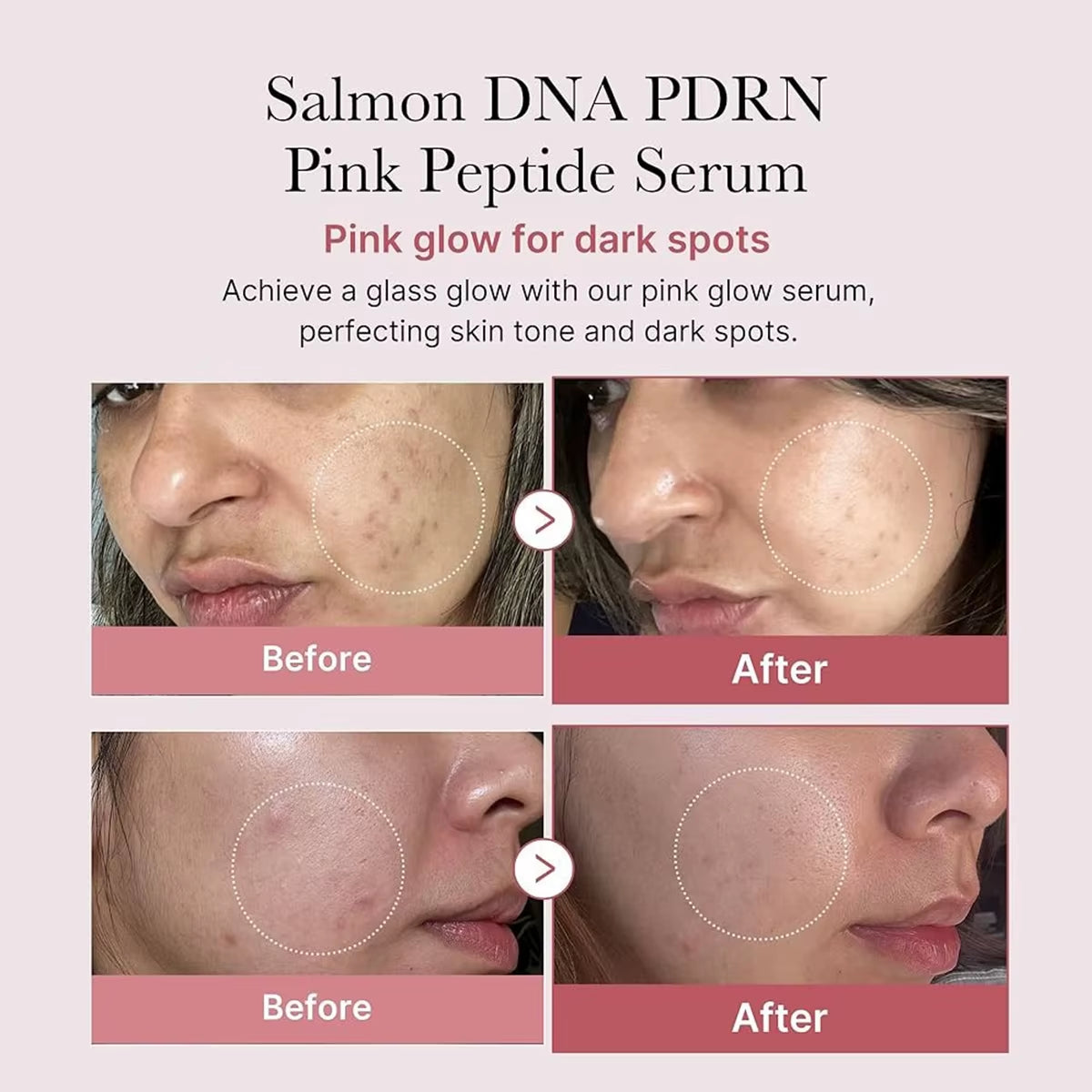 Salmon DNA PDRN Pink Peptide Serum,Serum Texture,Complex Repair Ingredients,Lifting & Firming,K-Beauty,Korean Makeup