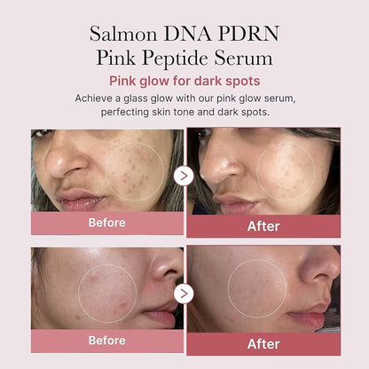 Salmon DNA PDRN Pink Peptide Serum,Serum Texture,Complex Repair Ingredients,Lifting & Firming,K-Beauty,Korean Makeup